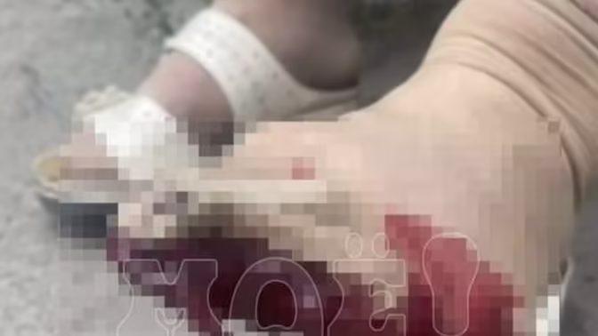 В Воронеже пенсионерка поранила ногу в автобусе, водитель торопил ее уйти